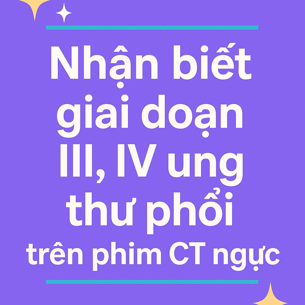Hình Ảnh Ung Thư Phổi Giai Đoạn III, IV Trên Phim CT Ngực: Cách Nhận Biết Chính Xác