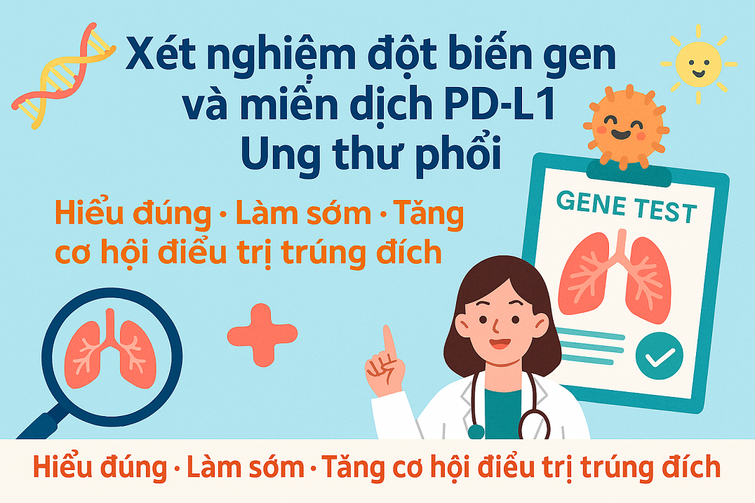 Xét Nghiệm Đột Biến Gen và PD-L1 Trong Ung Thư Phổi: Khi Nào Cần Làm và Vì Sao Quan Trọng