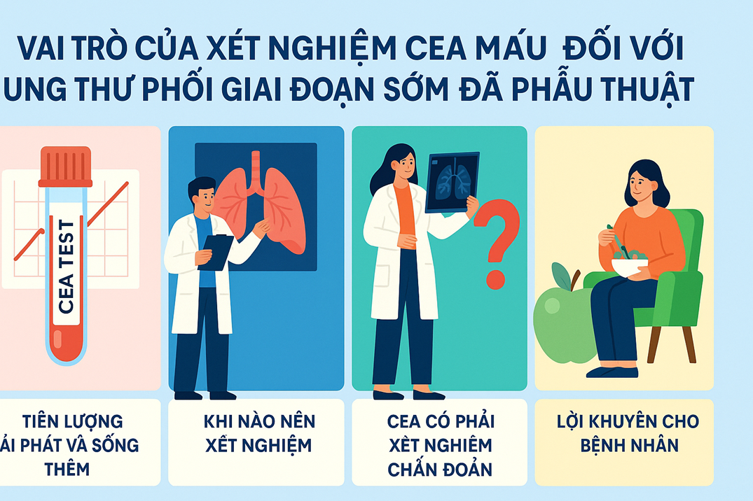 Vai trò của xét nghiệm CEA máu đối với ung thư phổi giai đoạn sớm đã phẫu thuật