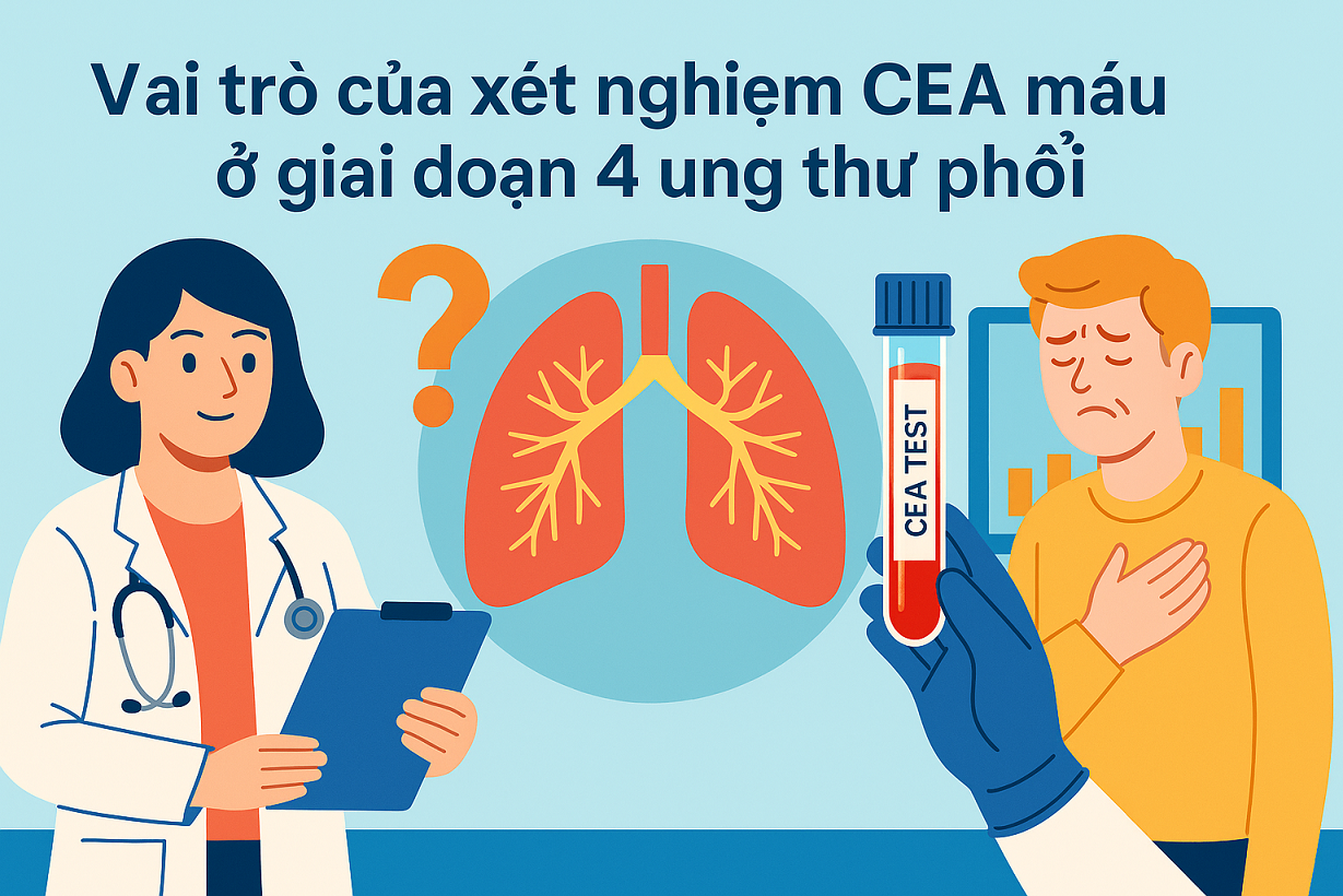 Vai trò xét nghiệm CEA máu ở giai đoạn 4 ung thư phổi