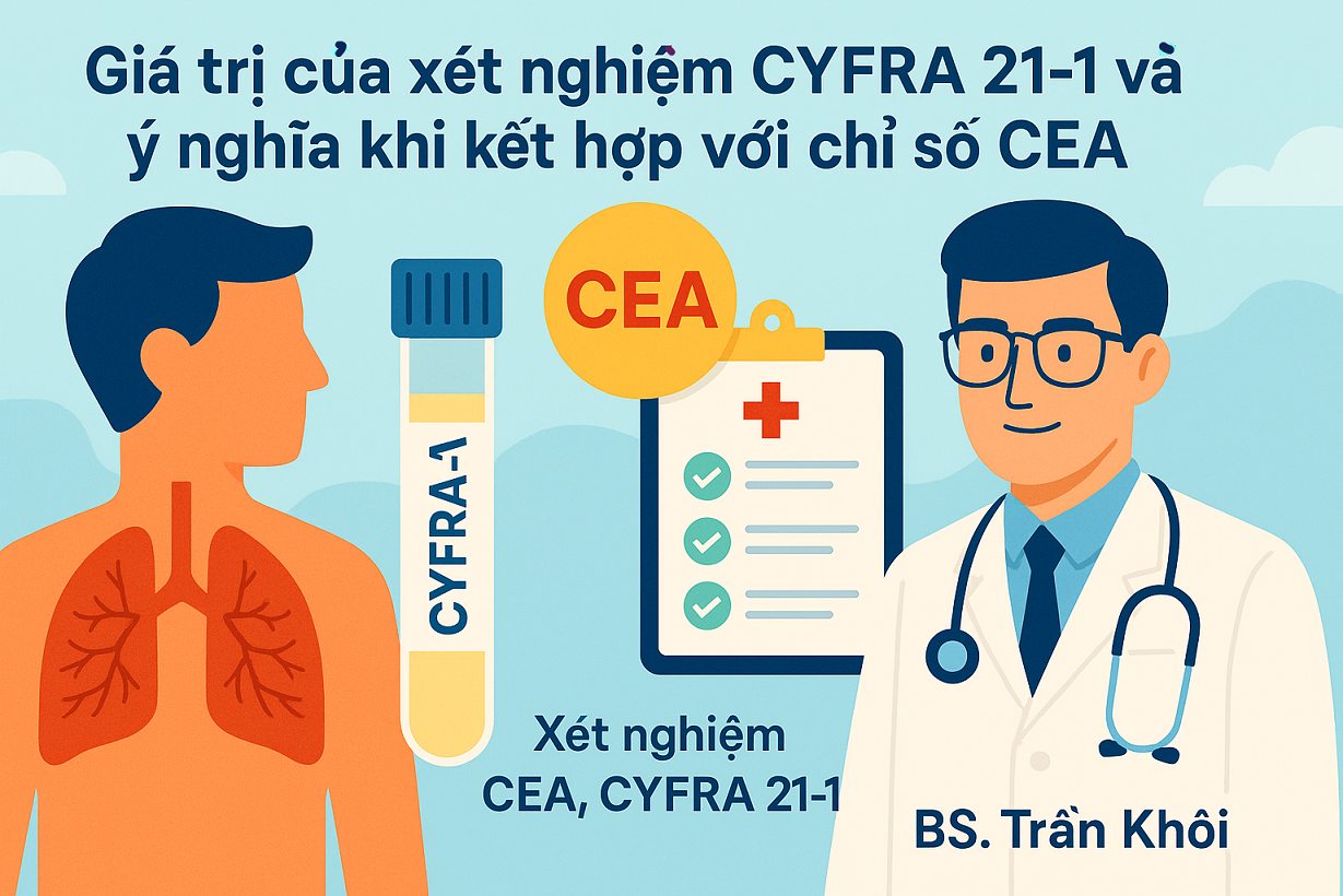 Giá trị của xét nghiệm CYFRA 21-1 và ý nghĩa khi kết hợp với chỉ số CEA trong ung thư phổi