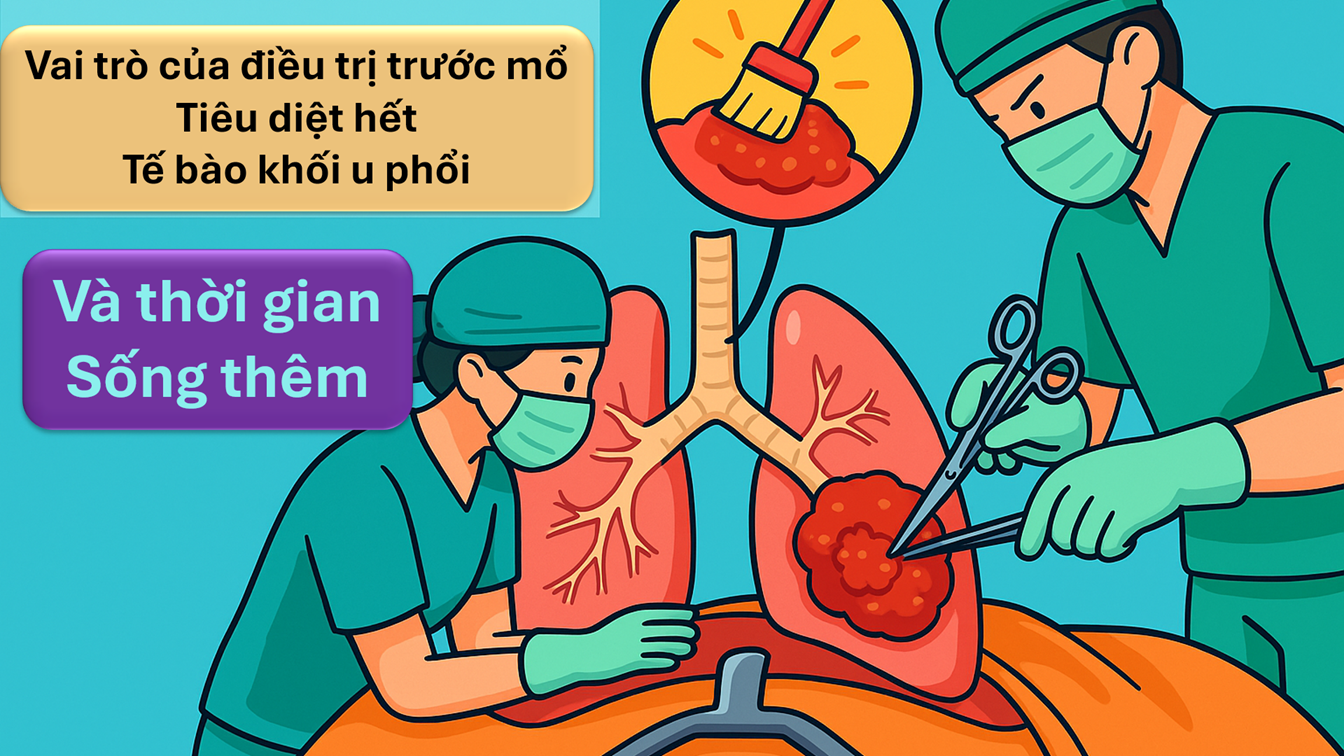 Điều trị trước mổ ung thư phổi: Cơ hội làm sạch tế bào u và sống lâu hơn